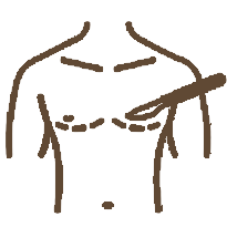 Traditional breastsuction