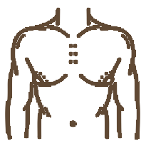 VASER breast