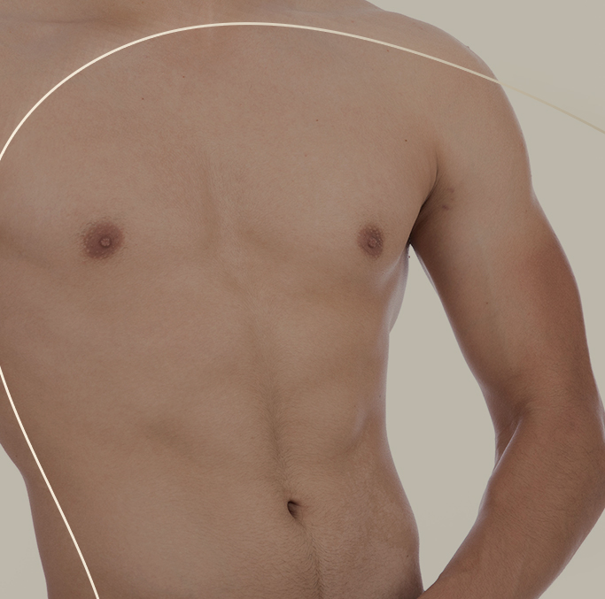 Incision Blepharoplasty Technique